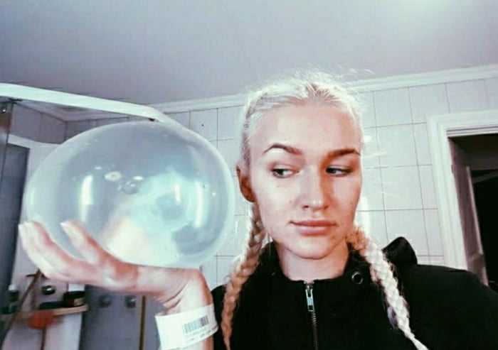 A throwback picture of me holding one of the two 1900cc bags of gel I had put into my body the day after this was taken