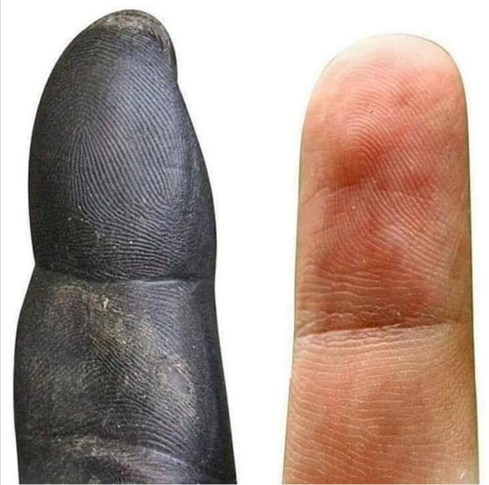 Chimpanzee finger VS human finger.
