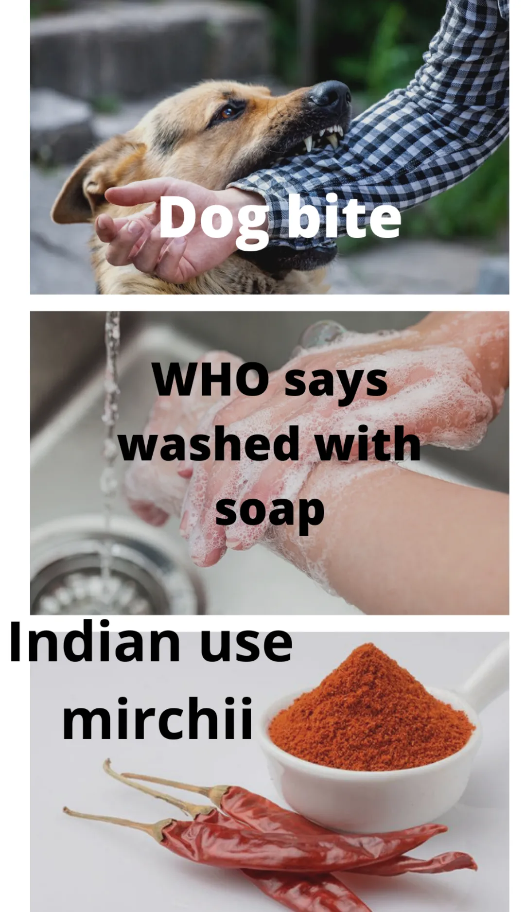 Dog bite