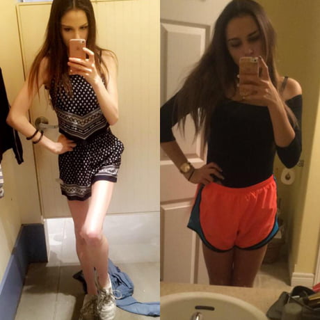 Goodbye anorexia, hello life