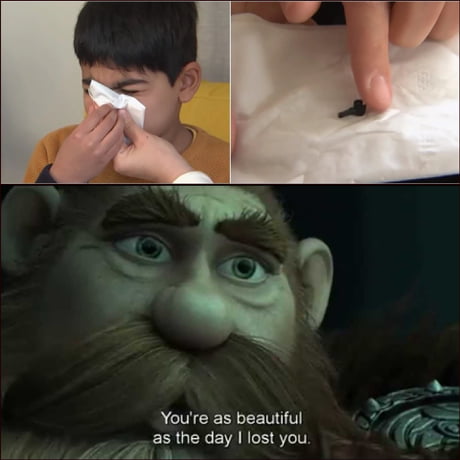 Kid finds Lego piece inside his nose two years after it got stuck