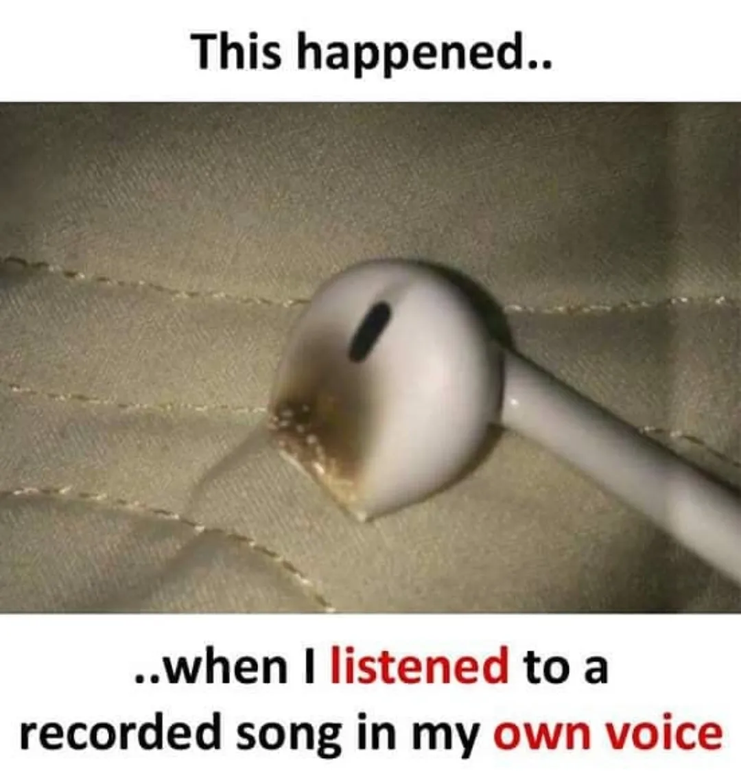 Ranu mandal se bhi kharab😔