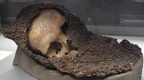 The skull of a medieval soldier still in his chain mail, having died during the Battle of Visby in 1361.